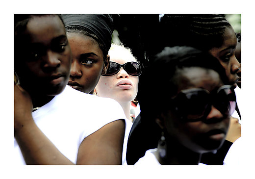Living with Albinism by John Ferguson